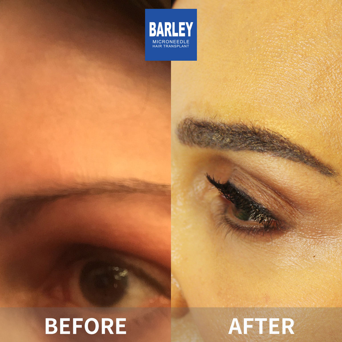 Natural Growth Pattern