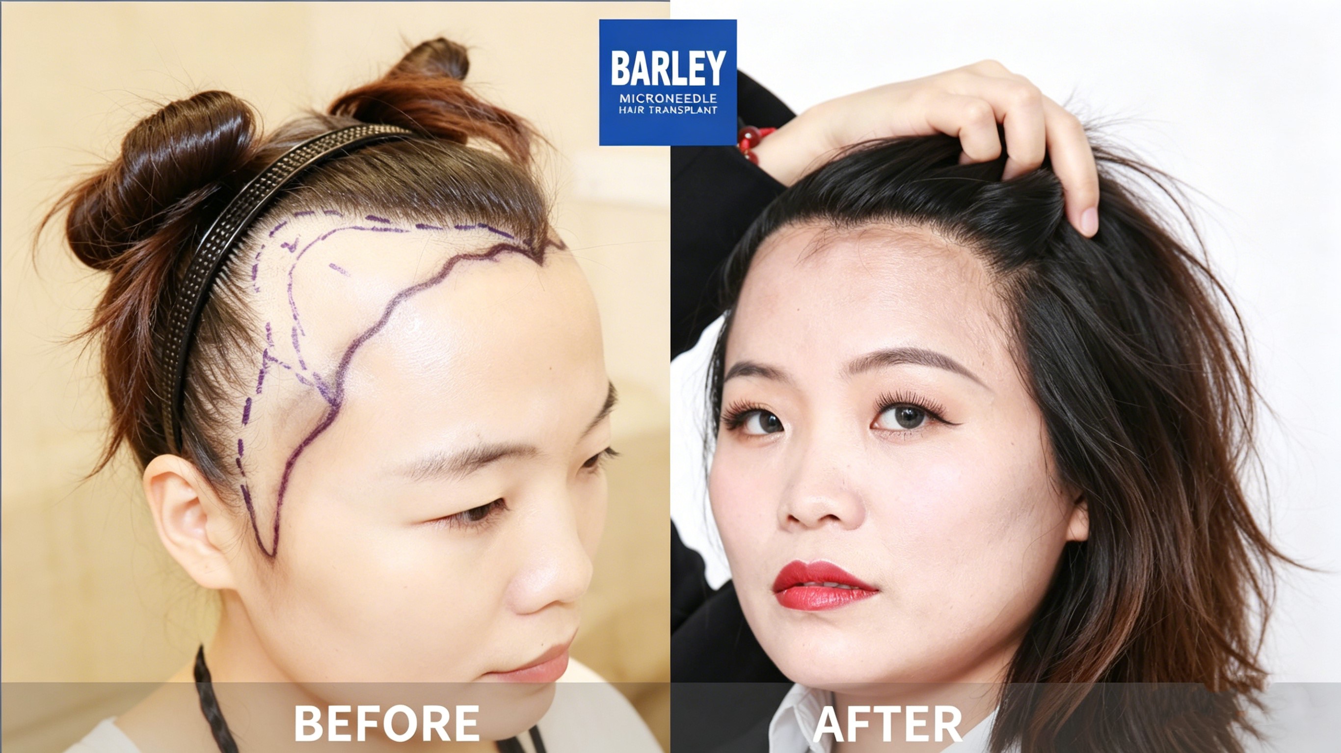 Remarkable Transformation