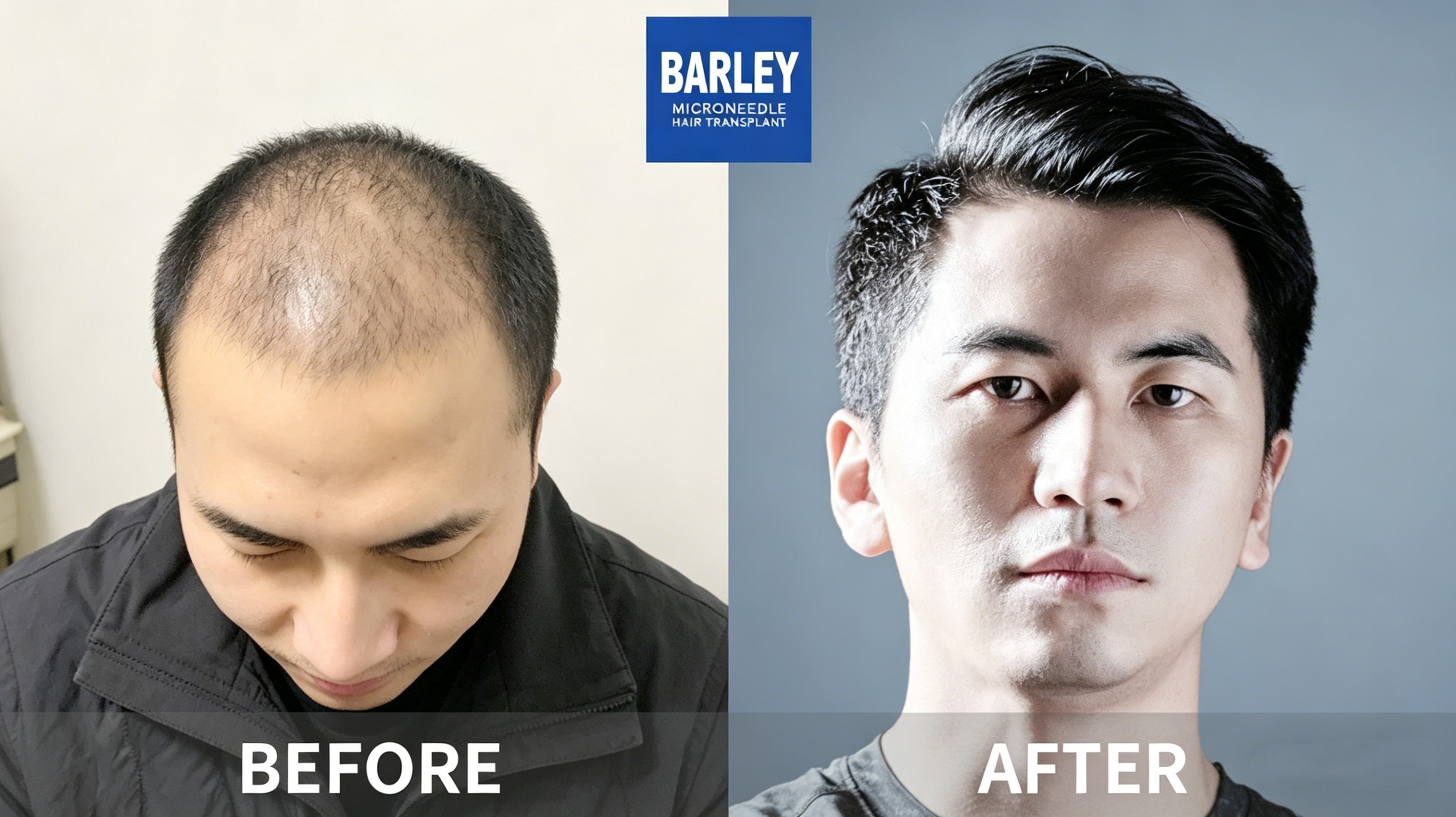 Life-Changing Hair Restoration