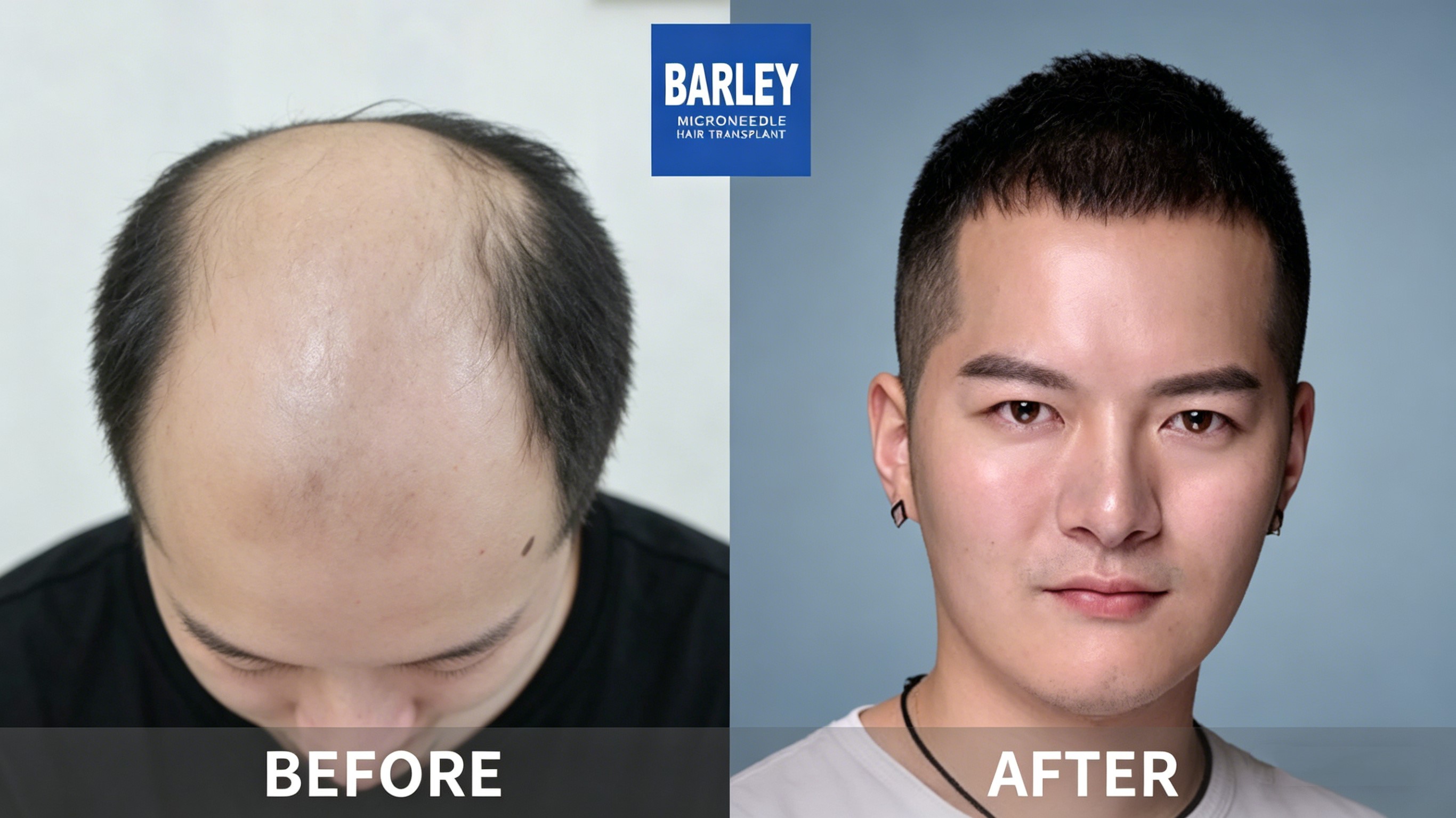 Premium Density Results