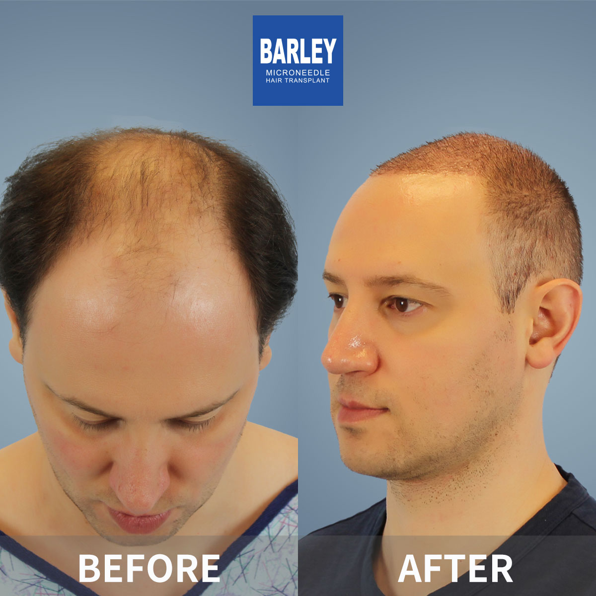 Natural Growth Pattern