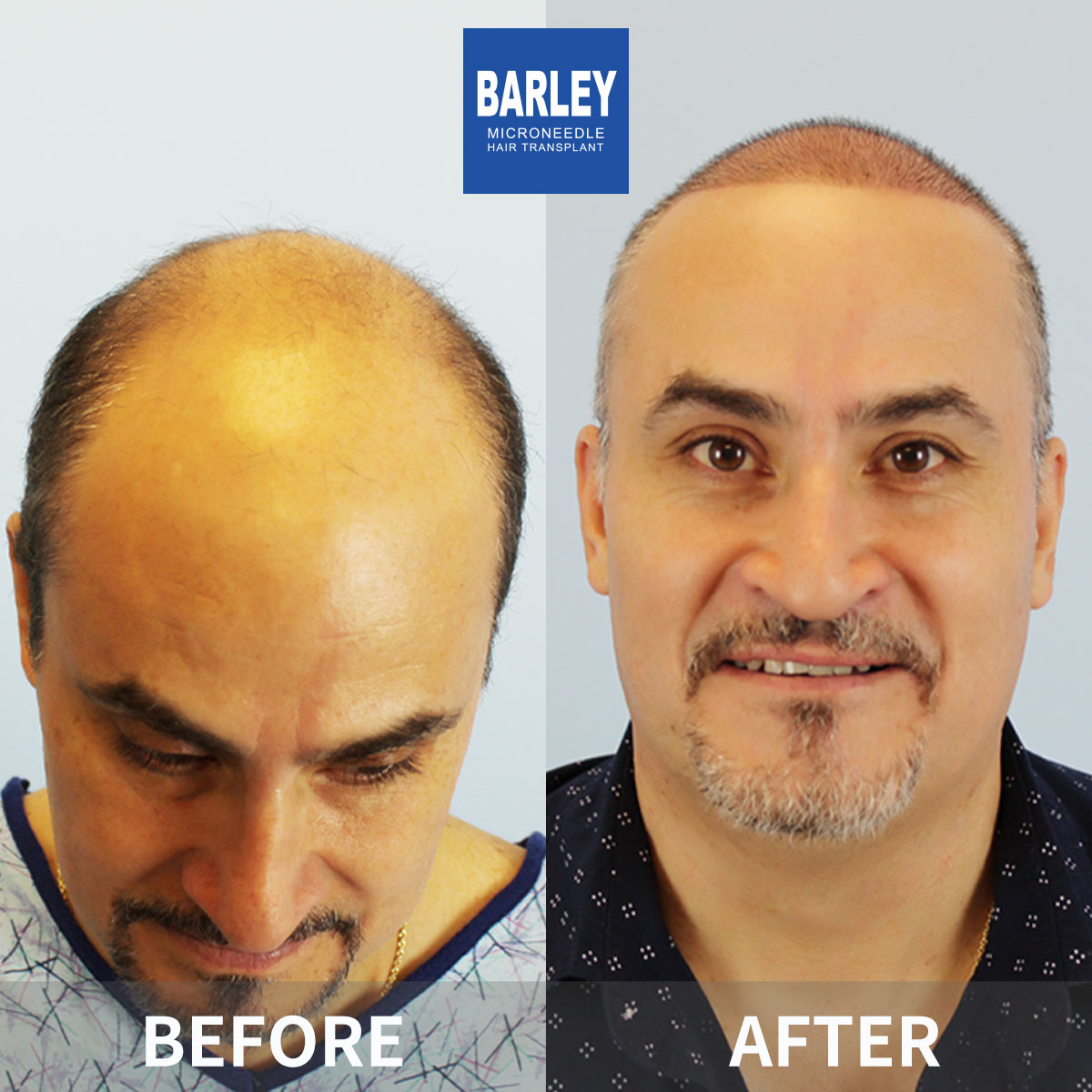 Artistic Hairline Design