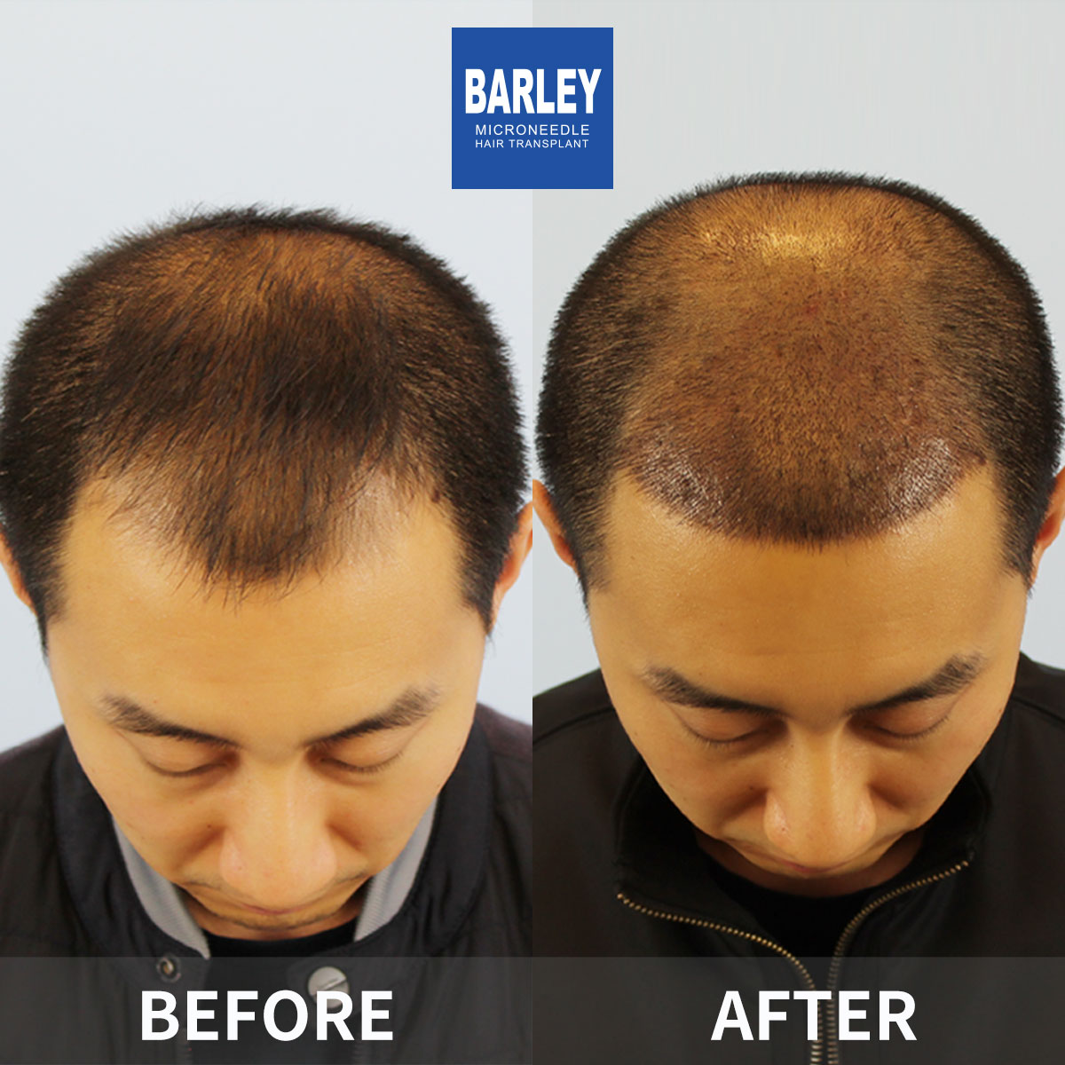 Artistic Hairline Design