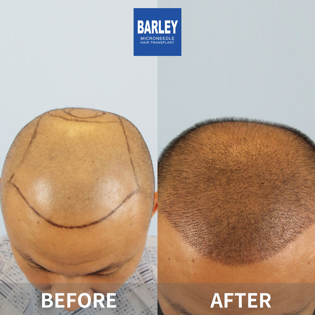 Natural Growth Pattern