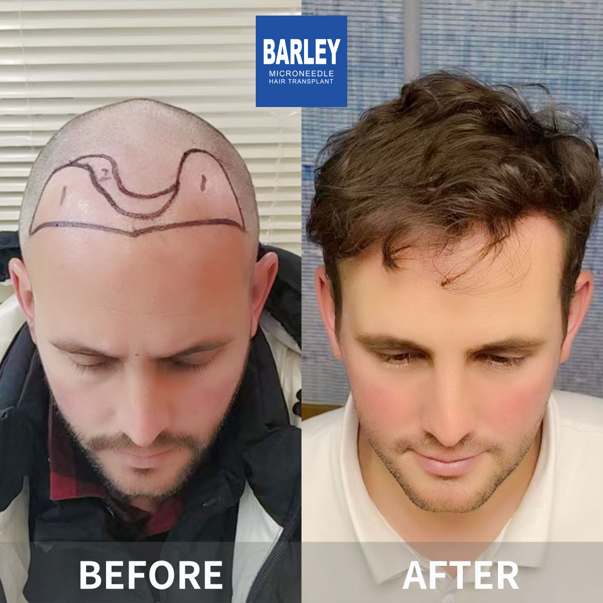 Natural Growth Pattern