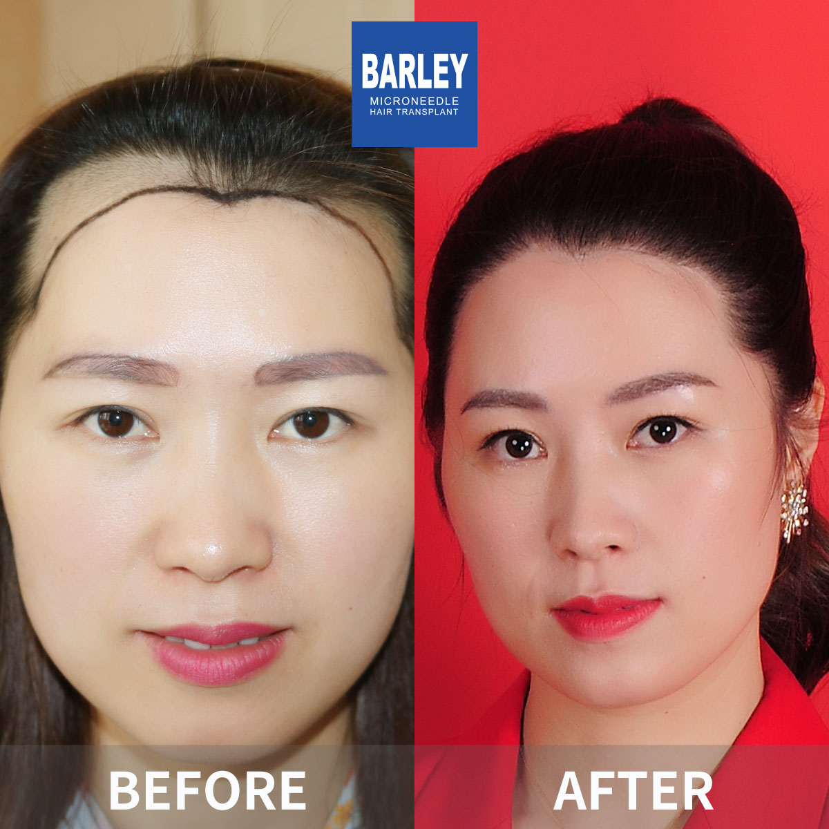 Artistic Hairline Design